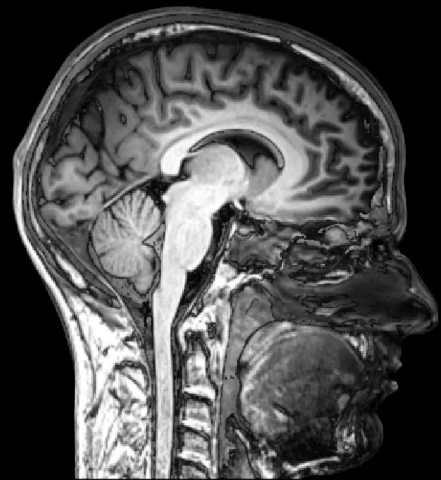 CT Scan Radiation Safety & ALARA - Radiology Patient Education