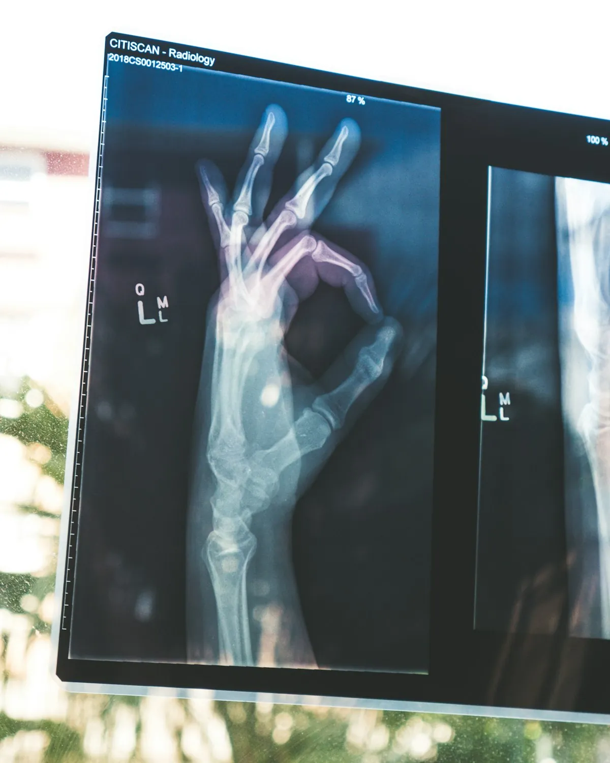 Clinical case studies - Advanced radiology imaging visuals